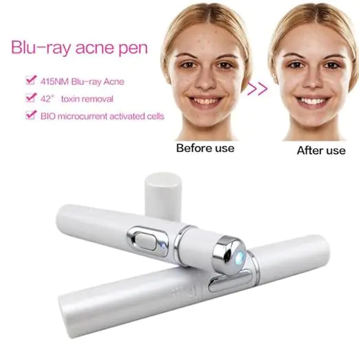 Wrinkle Pore Remover Pen